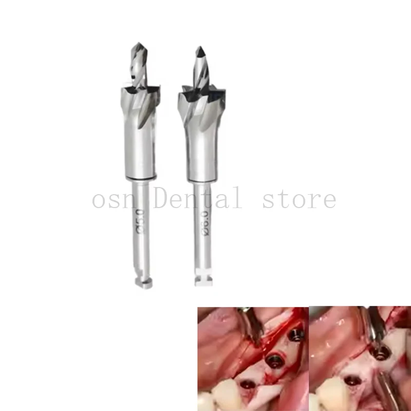 Dental Implant  Bladed Alveolar Ridge Trimmer Drill & Bone Profiler With Pilot Drill for Implant Surgery Instrument