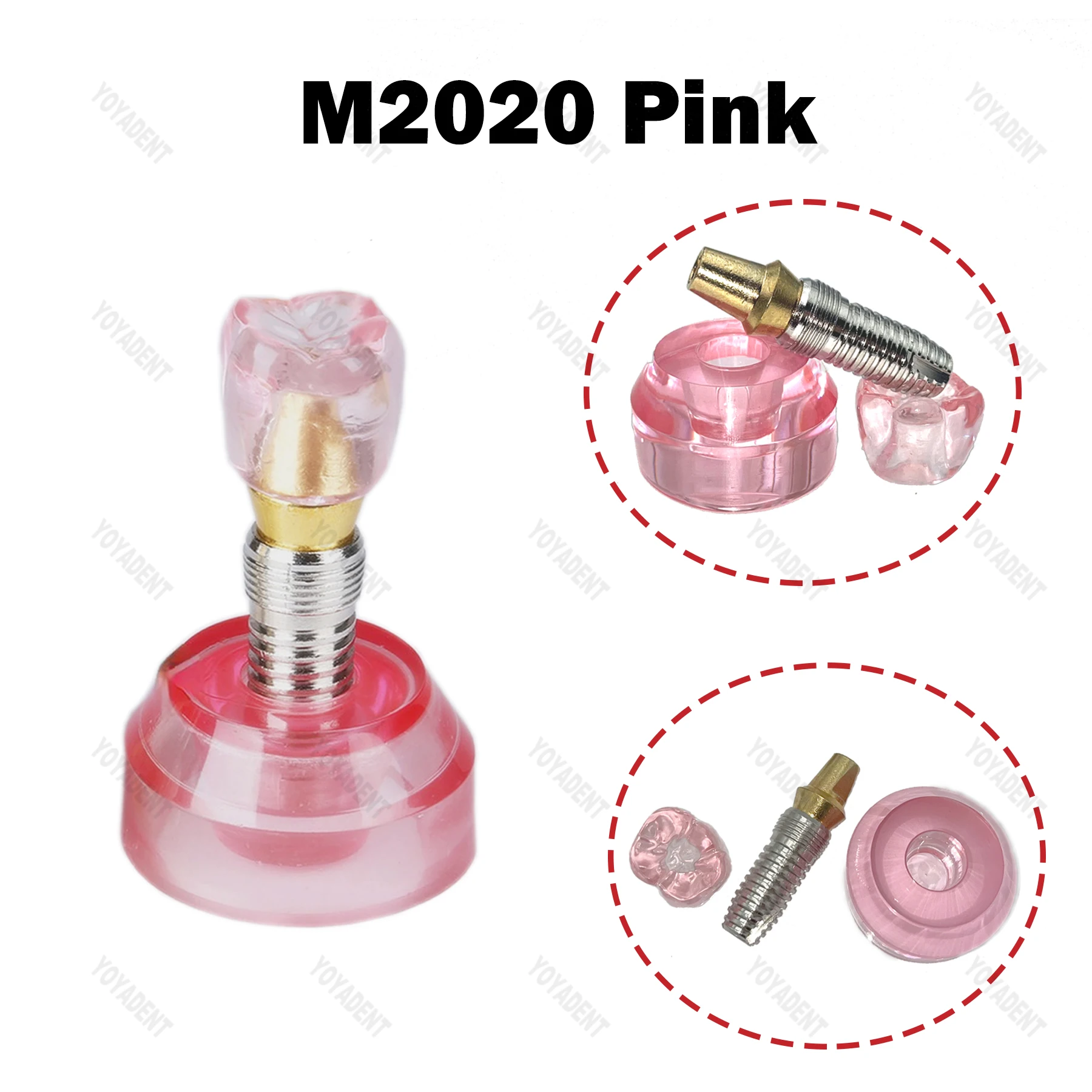 Стоматологическая модель 2,5x размера, модель имплантации зубов, обучающие модели зубов для стоматолога, связь пациента, демонстрационные аксессуары для стоматологии