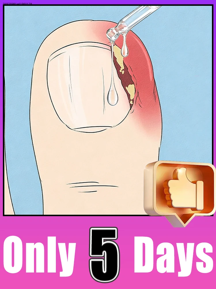 

Bʀᴇᴀᴋ ғʀᴇᴇ ғʀᴏᴍ ᴅʀʏ ᴄʀᴀᴄᴋᴇᴅ ᴄᴜᴛɪᴄʟᴇs, ᴋᴇᴇᴘ ғɪɴɢᴇʀᴛɪᴘs sᴏғᴛ ᴀɴᴅ ɴᴏᴜʀɪsʜᴇᴅ