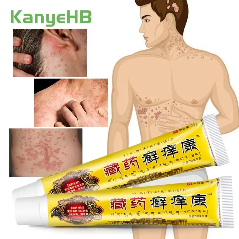 

2Pcs Psoriasis Cream Scrotum Itching Rash Dermatitis Eczema Treatment Herbal Ointment Tinea Pedis Inhibit Fungi Skin Care A947