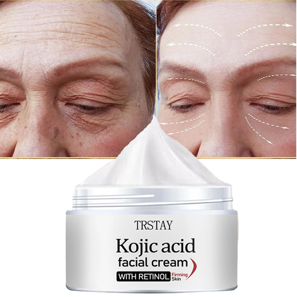 

TRSTAY крем для лица с койевой кислотой, ретинол, отбеливание и подтяжка кожи лица, уход за кожей для мам и детей