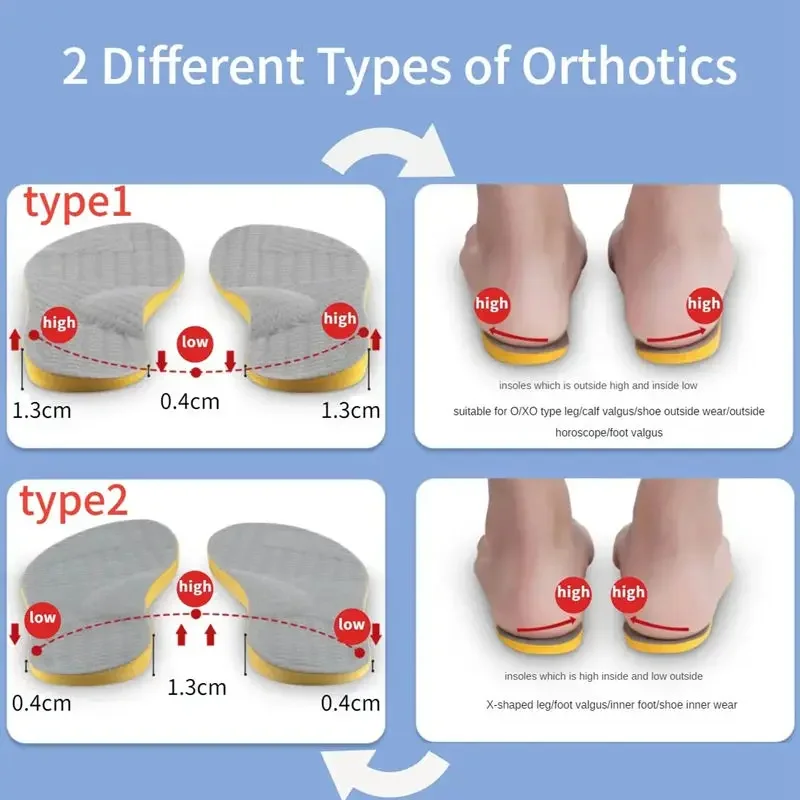 NEW PU Orthotic Insole for Flat Feet Arch Support Orthopedic Shoes Sole Insoles for Feet Men Women O/X Leg Corrected Care Pad