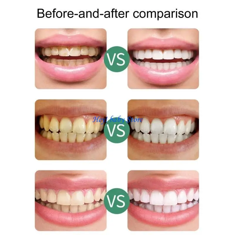 Q1FE 3pcs per bambini sbiancante per sbiancante per pulizia per pulizia spugna per pulizia dei denti strisce per cure denti