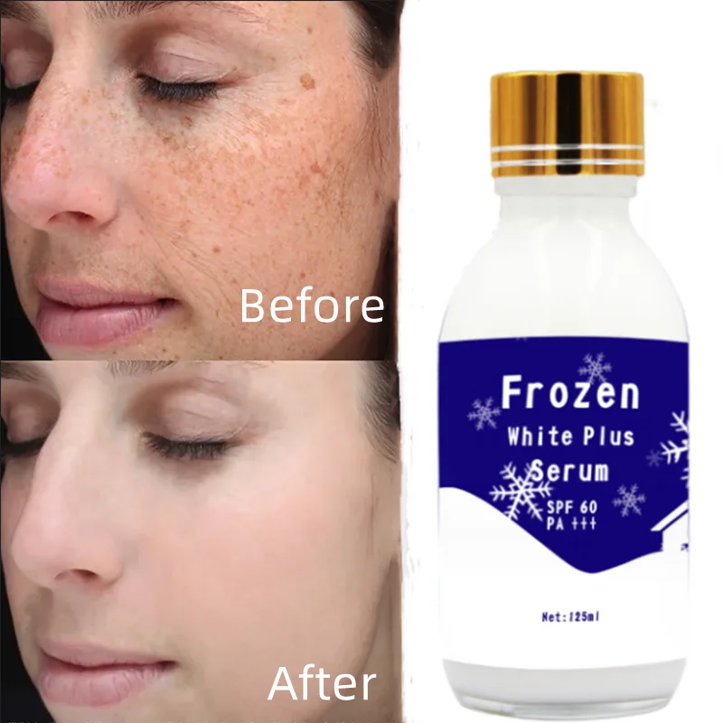 125ml Kojic Sen Concentre With Collagen Serum Strong Brightening Fade Stubborn Dark Spots More Radiant Even Complexion Serum