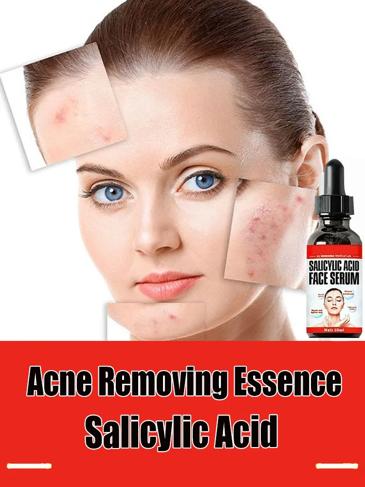 

Hot Sales Salicylic Acid Solution Essence 10mL Shrink Pores and Acne Spot Removing Shrink Pores Oil-Control Brighten Face Skin