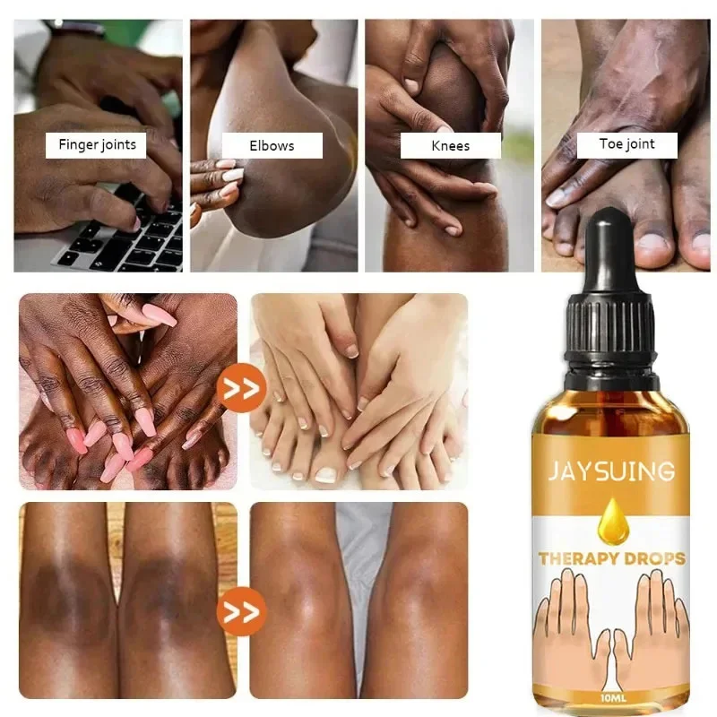 Dark Knuckles Fast Brighten Serum Elbows Hand Knuckle Brightening Serum Knee Black Skin Quickly Lighten Stains Remover Essence