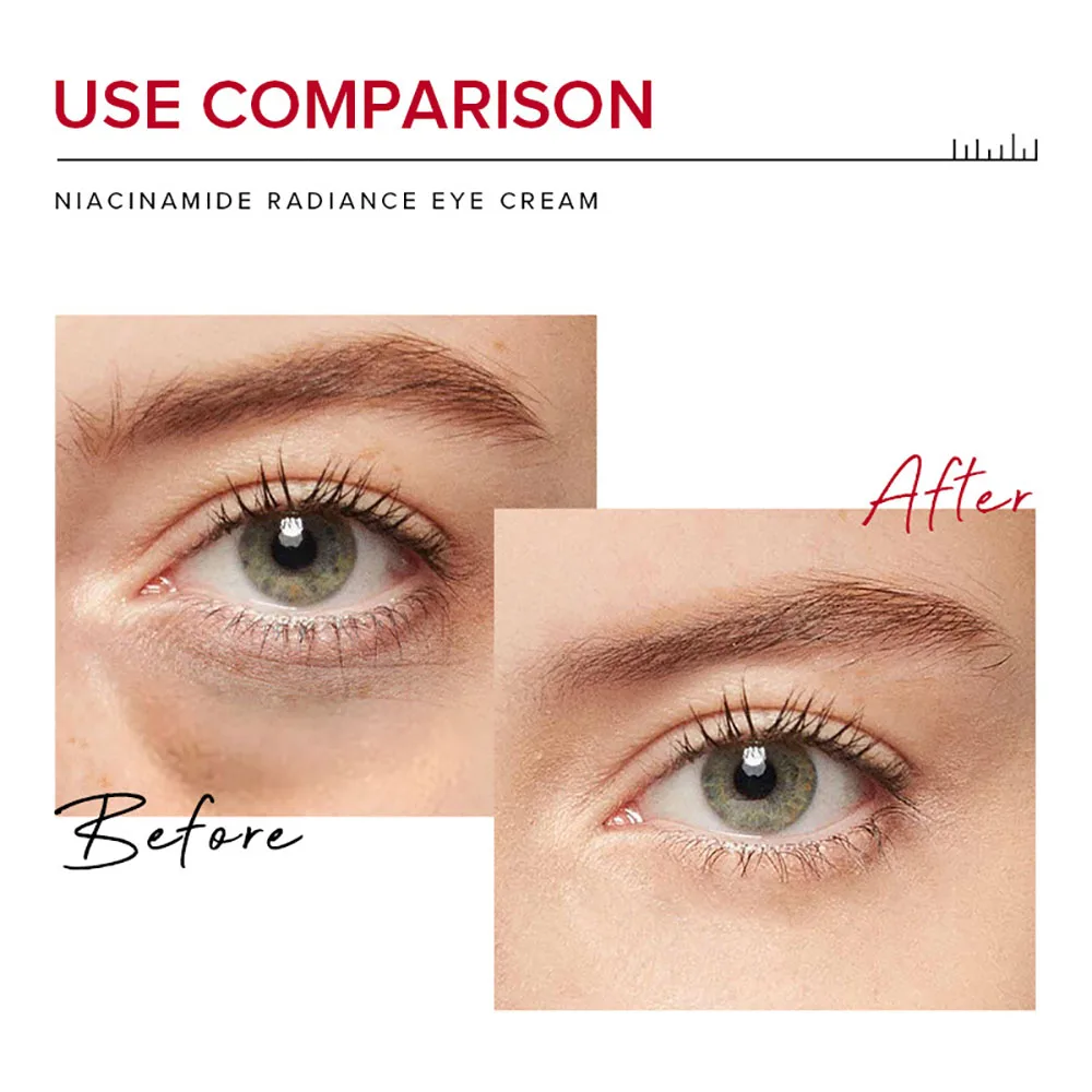 

LAIKOU 20g Pro Brightening Eye Cream, Niacinamide Hyaluronic Acid Anti Dark Circles Eye Puffiness Fade Fine Lines Moisturizing