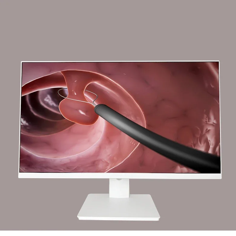 medical 4k monitor4k Color surgical display monitors equipment 21.5''  27'' complete hd endoscopic camera system LCD monitor