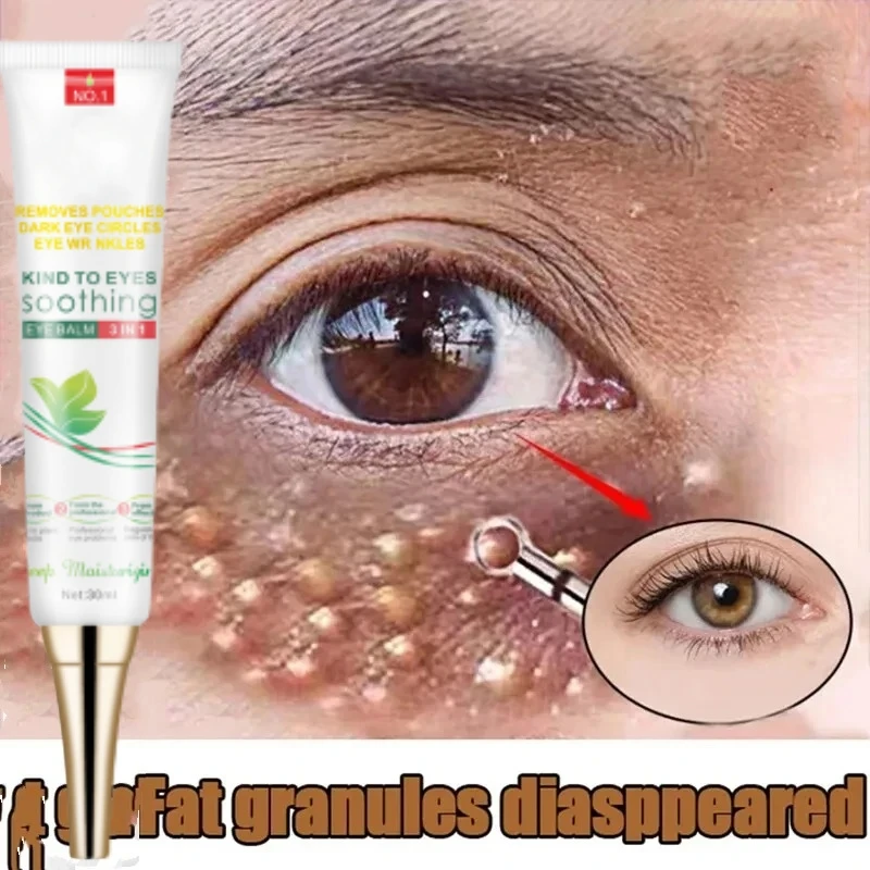 Creme removedor de grânulos de gordura para os olhos, creme anti-inchaço para rugas, clareia olheiras, desbotamento de linhas finas, hidratante, cuidados com os olhos