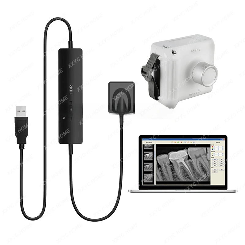 

Медицинский беспроводной высокочастотный инвертор, портативный рентгеновский датчик, цифровой рентгеновский датчик