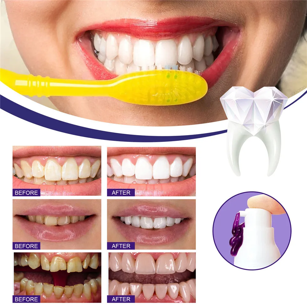 V34 30ml SMILEKIT Purple Whitening Toothpaste Remove Stains Reduce Yellowing Care For Teeth Gums Fresh Breath Brightening Teeth