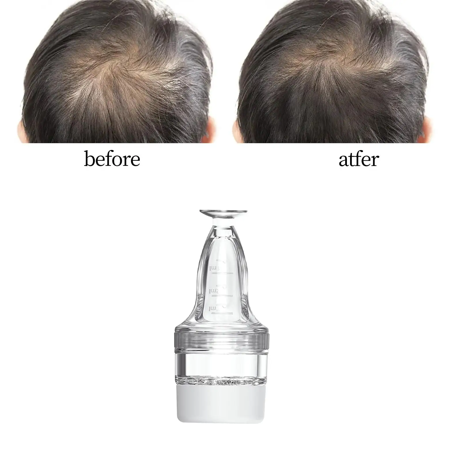 Scalp Oil Applicator Comb 3ml Portable Hair Oil Applicator with Clear Scales