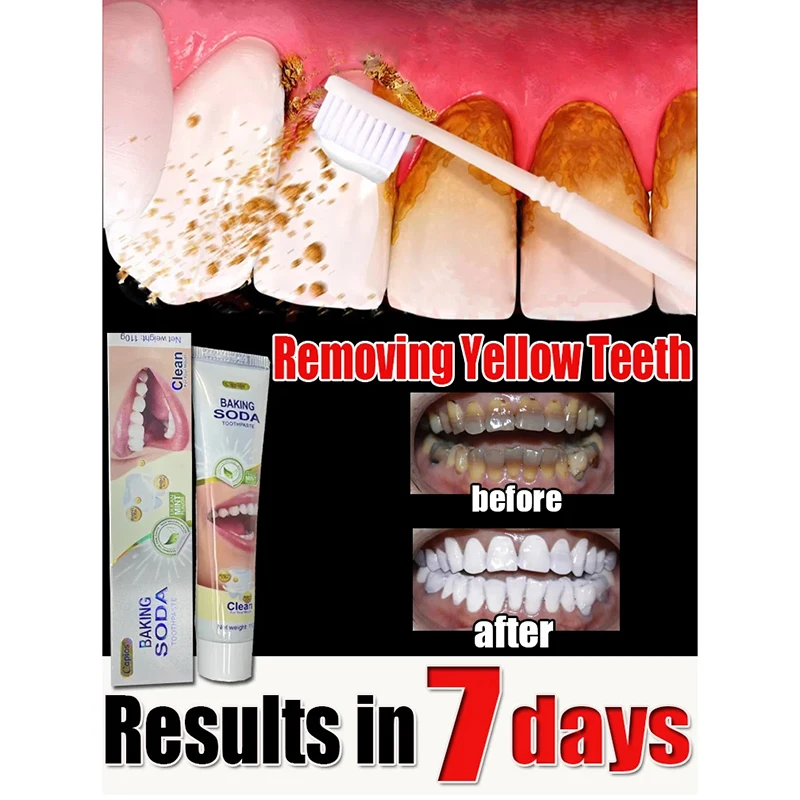 Remover Dental Calculus Toothpaste Removal Bad Breath Preventing Periodontitis Remove Yellow Teeth Cleansing Care Toothpaste