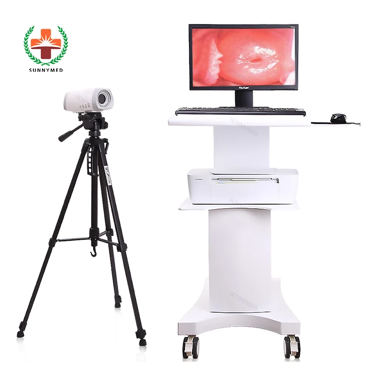 Sy-F004 digital electronic video colposcope for gynecology Handheld Gynecology Colposcopy system