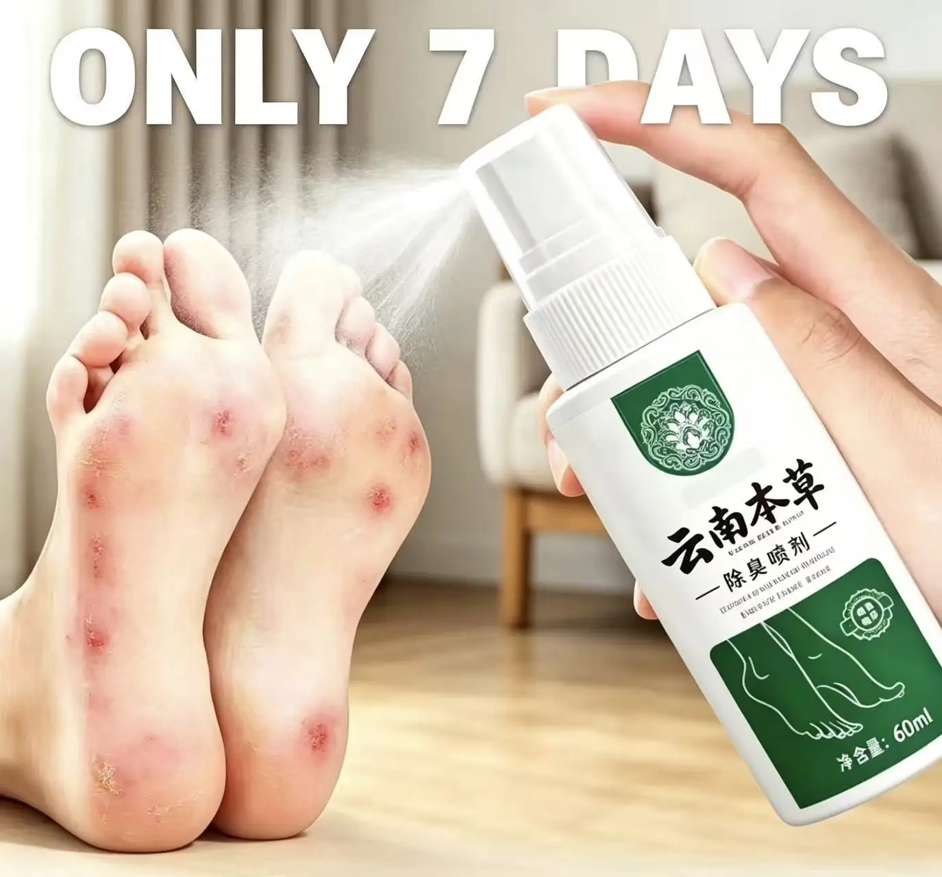 Bacteriostatic Spray Yunnan Herb To Beriberi Feet Smelly Wolf Illness Spray Feet Peeling Rotten Feet Blisters Foot Care Tools