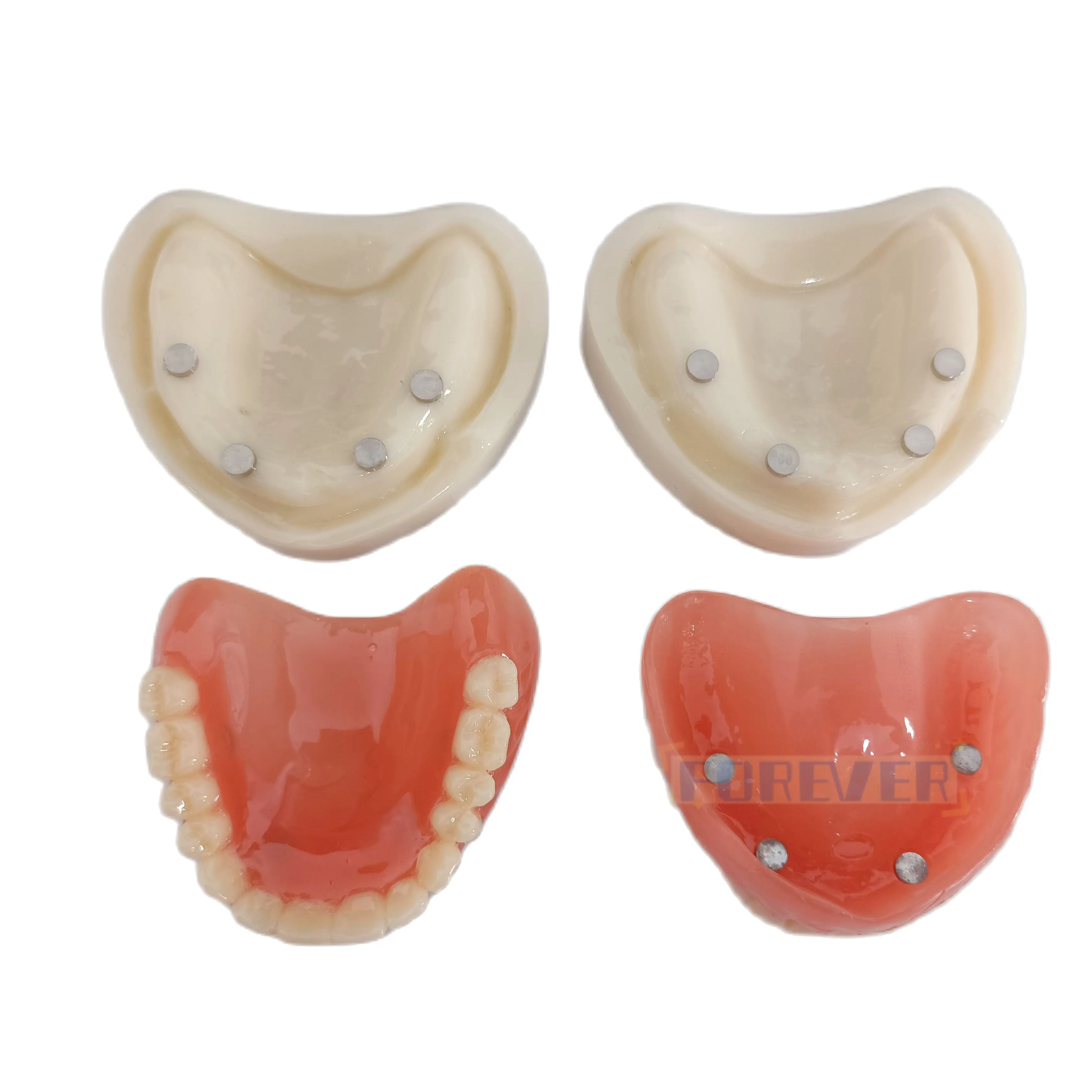 Dental Model Full Denture Magnetic Upper/Lower Attachment Study Mandibular