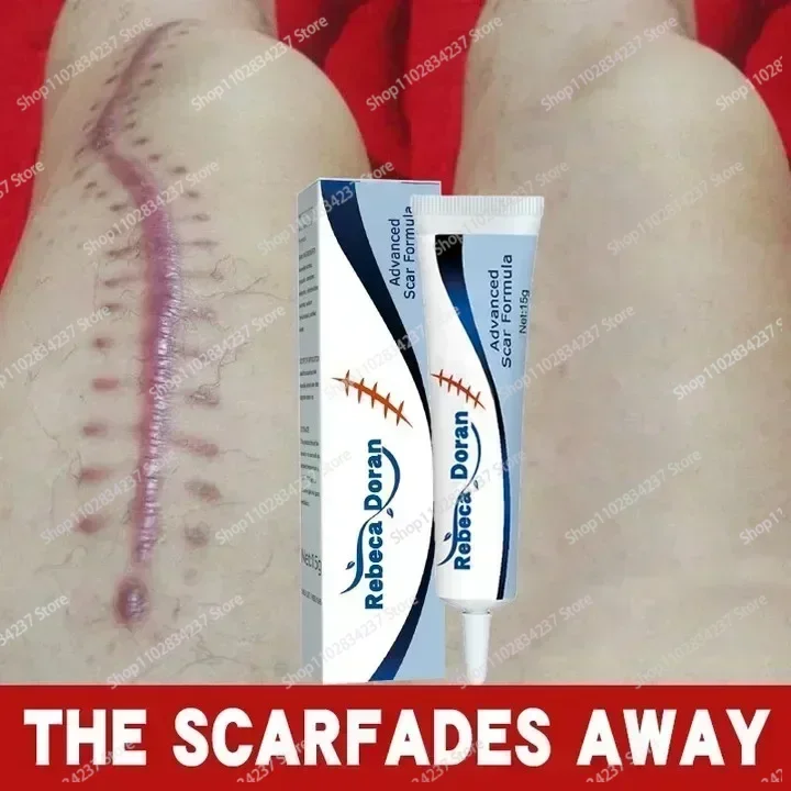 Scar effective repair surgical scars stretch marks acne pits pockmarks burn scars repair