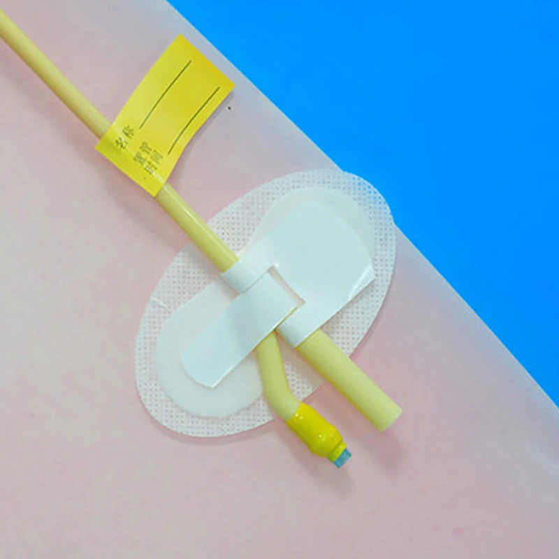 Catheter Holder Tube Leg Sticker Tape Fixing Urinary Clip Securement Legband Fixation Urine G Device Drainage Anchor Stabilizer