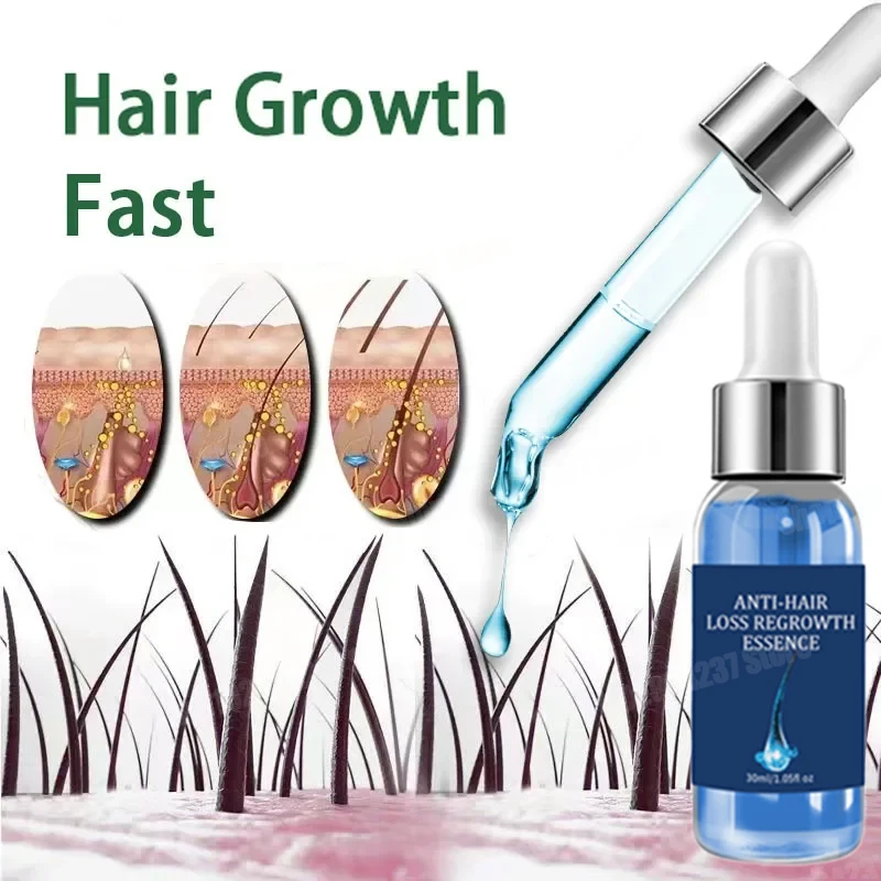 

Effective Fast Hair Growth Oil Baldness Repair Hereditary Hair Loss Postpartum Hair Loss Seborrheic