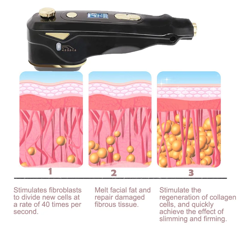 HIFU Macchina Lifting del viso Rassodante per la pelle Dispositivo per il viso Anti-età Rimozione delle rughe Cura della pelle ad ultrasuoni Dispositivi di bellezza per uso domestico