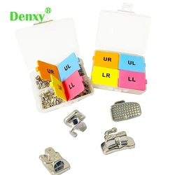 200pcs/box 1st/2nd Buccal Tubes Wide Entrance MIM Molar buccal tube Monoblock Non-Convertible orthodontic bracket Dental Product