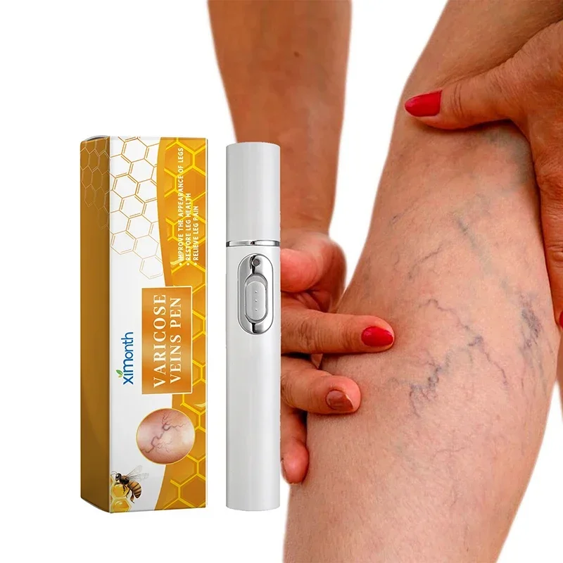 Stylo de réparation des jambes thérapeutique, amélioration du surpoids sanguin, varices Charleroi eves, inconfort des jambes, produit d'abat-jour, soins de la peau