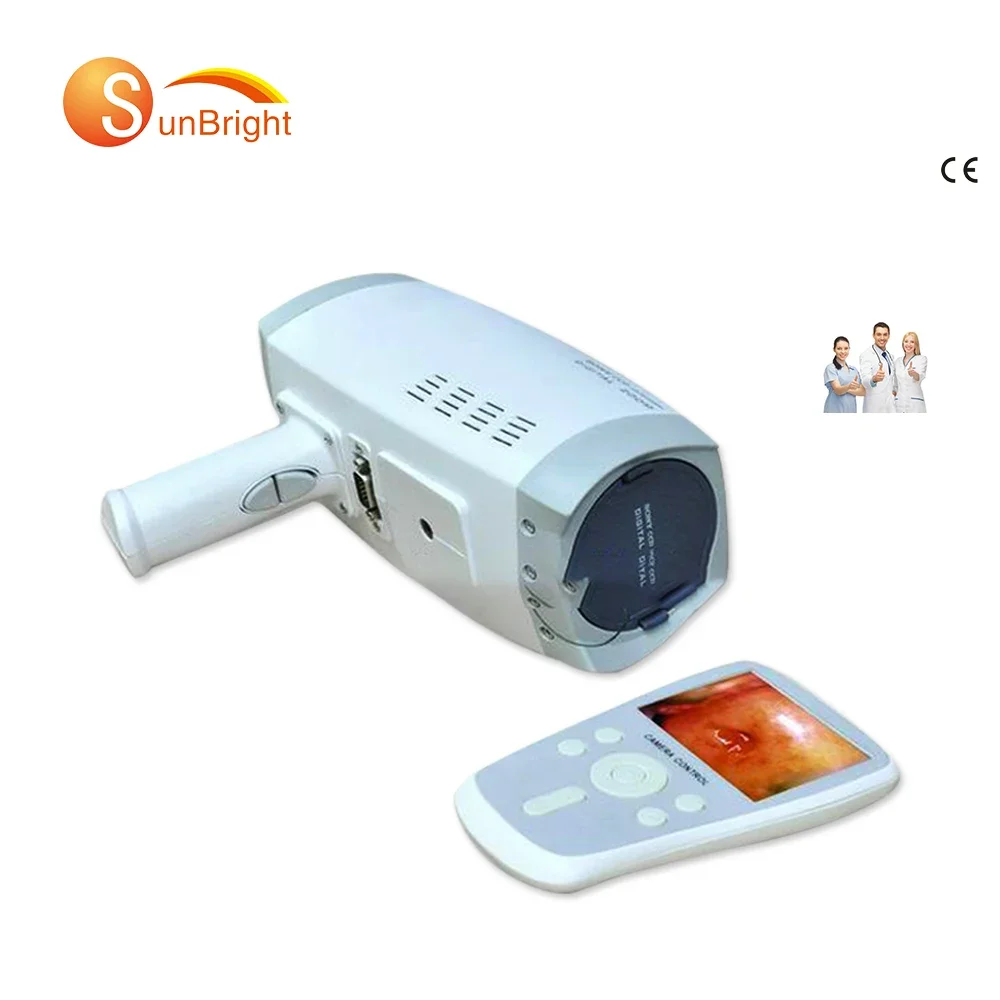 Gynecological Hospital Using Instrument Doctor Portable Colposcope HD Camera