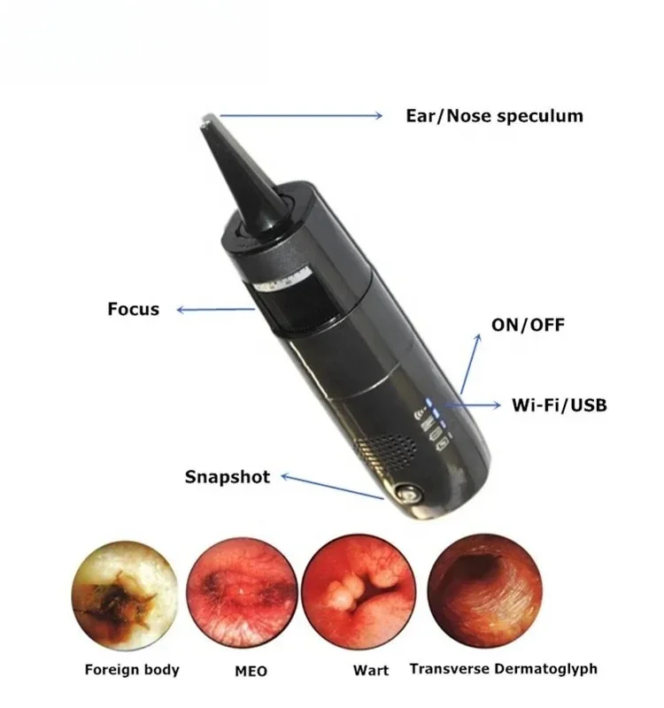 Digital Wifi Microscope Support  IOS/Android/WIndows with HD Video Household Wifi Otoscope Wireless Endoscope