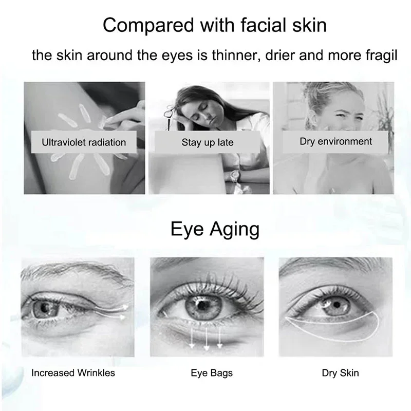 Nicotinamide Eyes Cream Fading Dark Circles Eye Bags Eye Hyaluronic Acid Moisturizing Serum Against Puffiness Eye Care Cosmetics