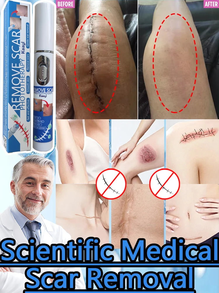 

For all kinds of scars Smooth Whiten Face Skin Care Fast Remove Burn Keloid Recovery Scar