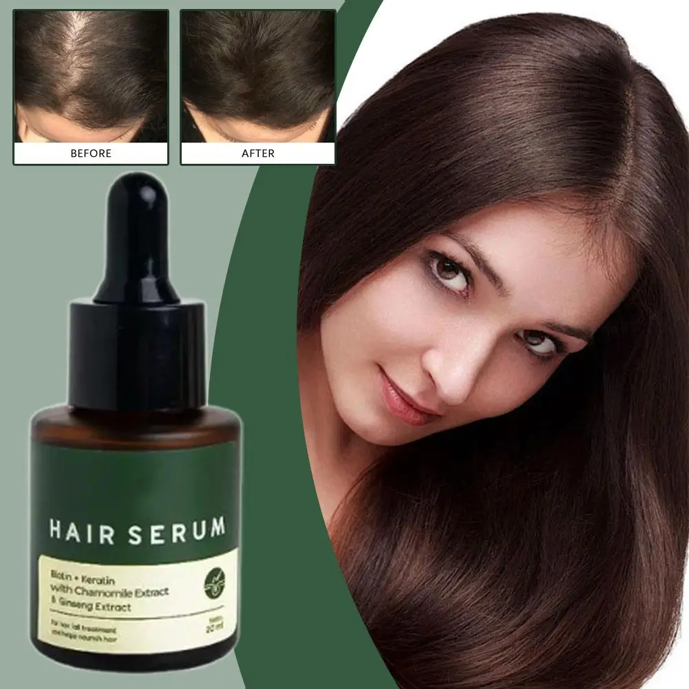 مغذي للعناية بالشعر، ظروف الزيوت العطرية، شعر فروة الرأس يقلل من التجعد، 20 مل، جذور الشعر W8G4 #1