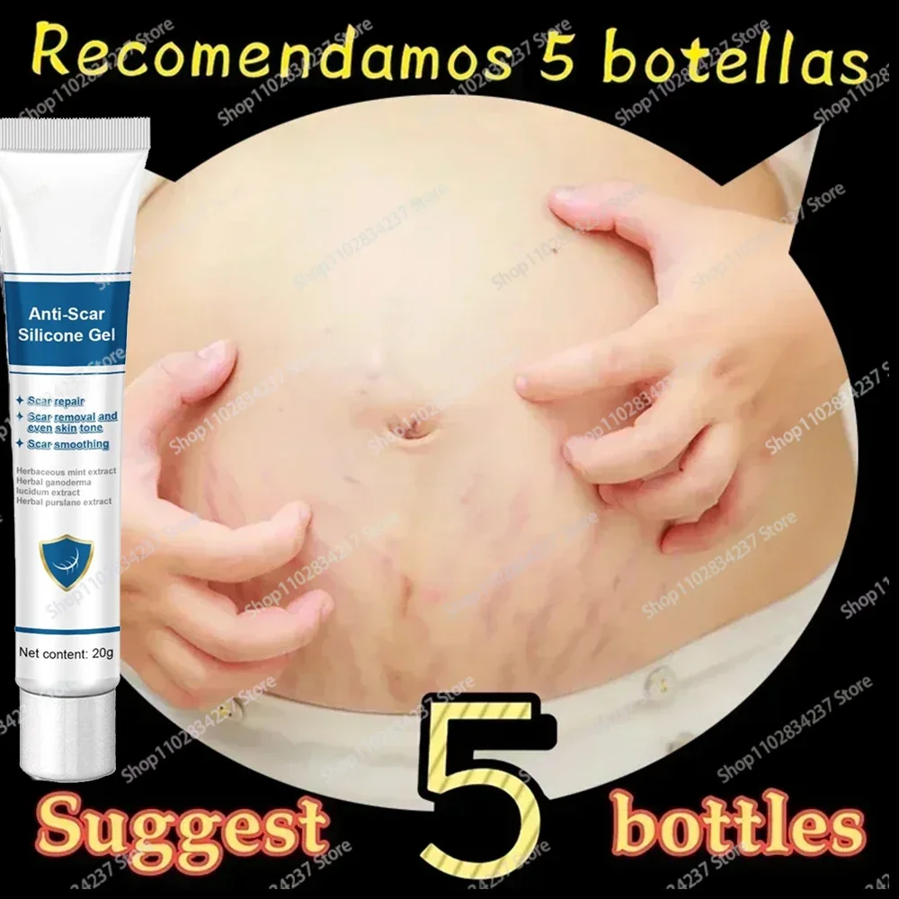 

Stretch mark removal cream, Postpartum repair of fat marks on thighs, Stretch mark removal