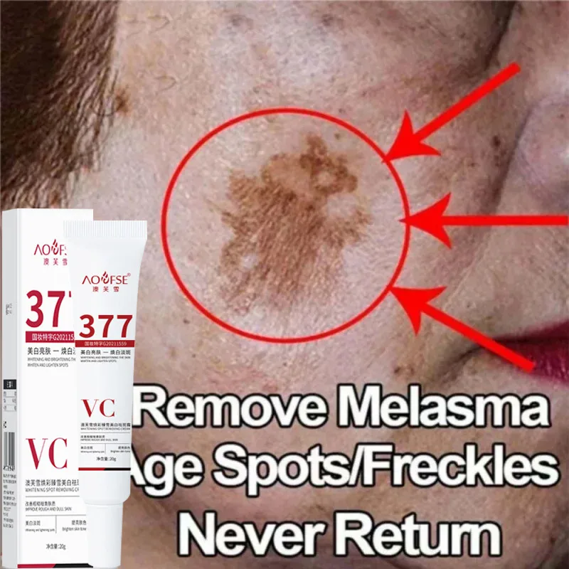 

Niacinamide Melasma Brightening Cream Reduce Melanin Brighten Cream Lighten Dark Skin Chloasma Repair Serum Face Care Products