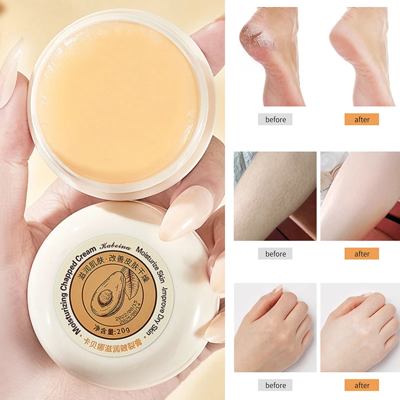 Herbal Anti Cracked Heel Treatment Cream Callus Dead Skin Balm Hand Foot Moisturizing Repair Skin Care Mask Anti-Drying Removal