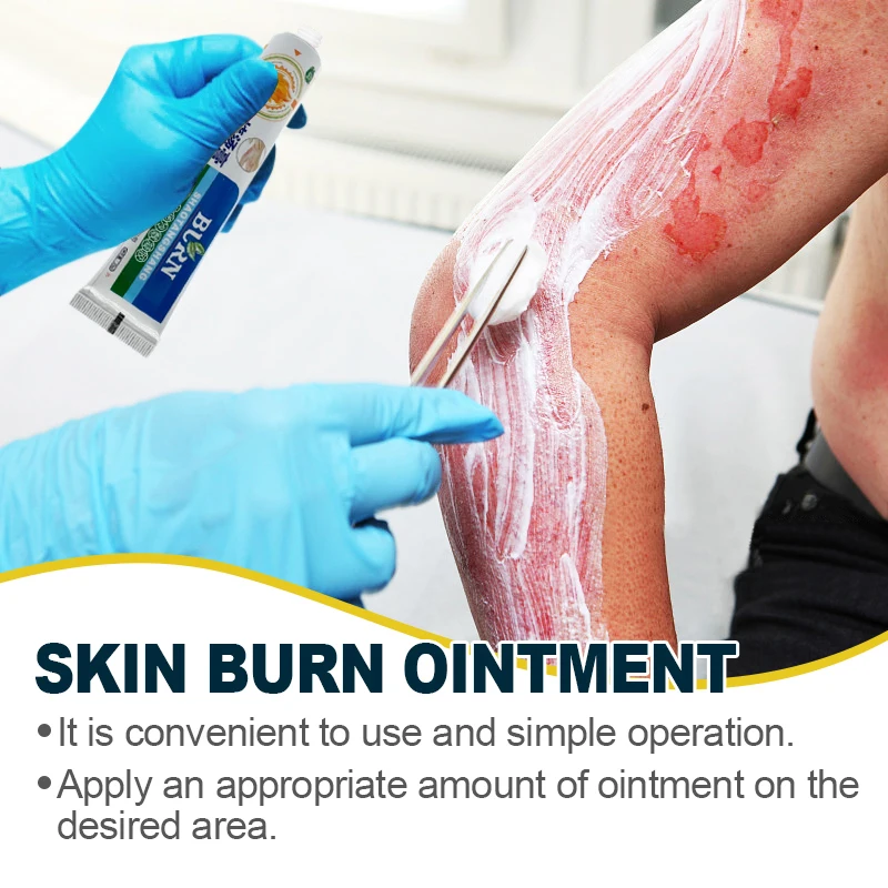 20g Burn Scald Ointment Inhibit Fungi Wound Repair Care Dressing Anti-infection Promote Skin Healing Antibacterial Cream