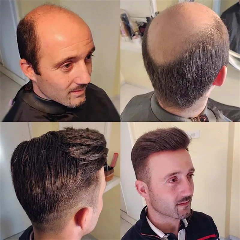 남성용 부드러운 스트레이트 가발, 모세 혈관 보형물, 내구성 시스템, 호주 프렌치 레이스 가발