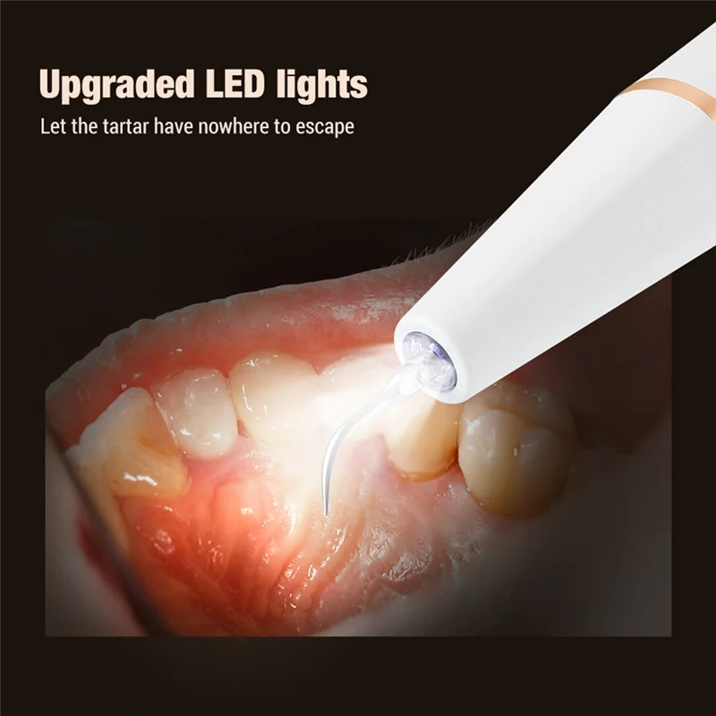 CKFAM-전기 음파 스케일러 LED 스케일러 구강 치아 타르타르 제거제 플라크 얼룩 클리너 제거 치아 미백