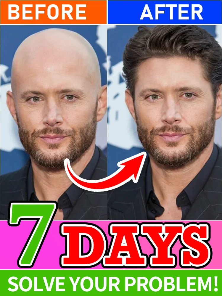 

98% of buyers buy again, have more and more hair, say goodbye to baldness, thick hair,Hot selling product