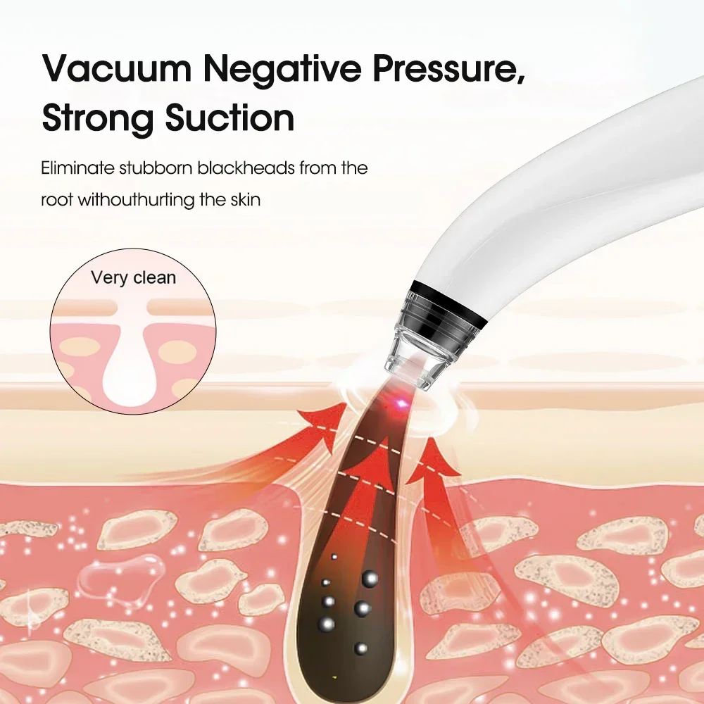 Camera Blackhead Remover Pore Vacuum Suction Pore Cleaner Deep Cleansing Blackhead Remover Pimple Remover Tool