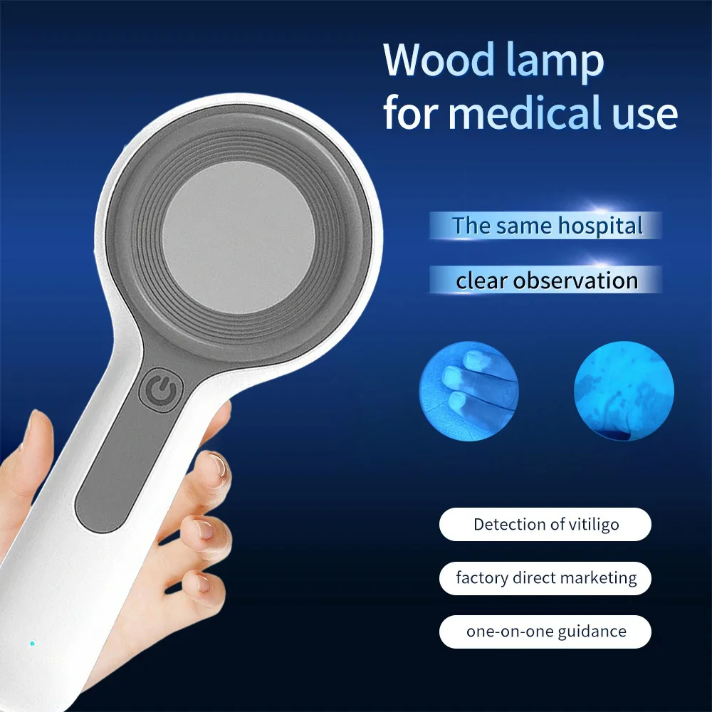 

Wood's Lamp Ultraviolet Skin Analysis For Skin Examination Test Medical Diagnostic Analyzer Machine Personal Beauty Care