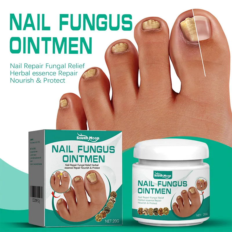 SOUTH MOON Nail Care Cream For Revitalizing Nails And Soft Gentle Nail Cream Nail Fungus Ointmen