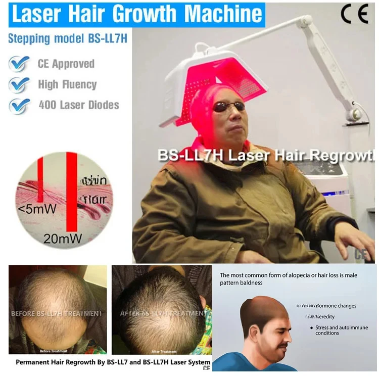 BS-LL7H Устройство для лечения выпадения волос Машина для восстановления роста волос