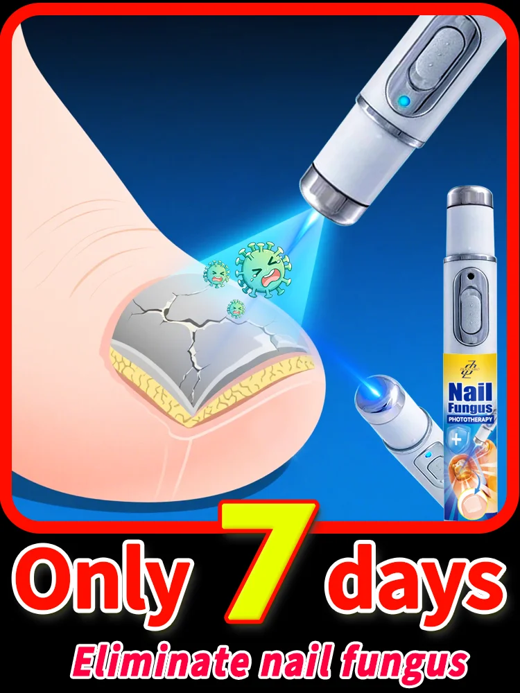 100% efficiënte sterilisatie van blauw licht, Nagelschimmel laser reparatietherapie, Activeer nagelgroei