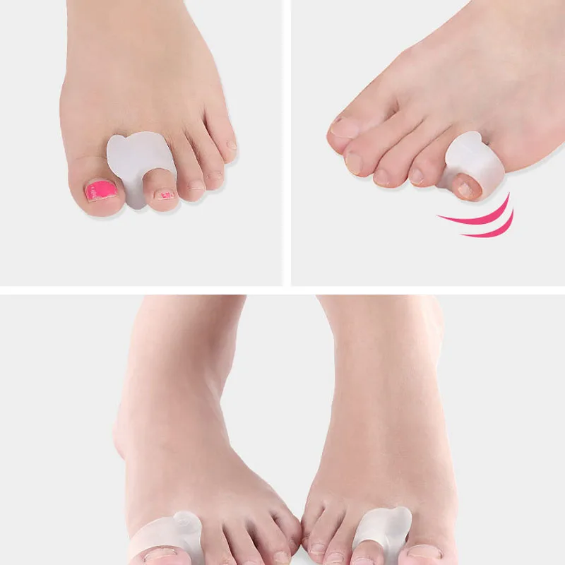 

Комплект из 2 силиконовых разделителей для пальцев ног, корректор для вальгусной деформации стопы, средство для ухода за ногами, корректор для пальцев стопы при халлюкс-валгусе