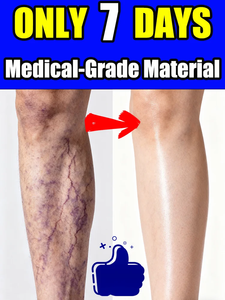 

Vᴀʀɪᴄᴏsᴇ ᴠᴇɪɴ ʟᴀsᴇʀ ᴘᴏɪɴᴛᴇʀ - ᴛᴀʀɢᴇᴛᴇᴅ ʟᴀsᴇʀ, ᴇғғᴇᴄᴛɪᴠᴇ ɪɴ 7 ᴅᴀʏs, sᴜɪᴛᴀʙʟ