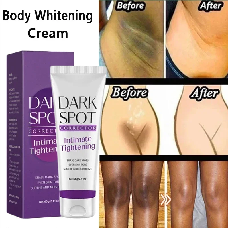 Creme Clareador Corporal para Áreas Íntimas, Clarear Pele Escura, Alvejante, Axilas, Joelho, Partes Particulares, Nutriir, Iluminar Produto de