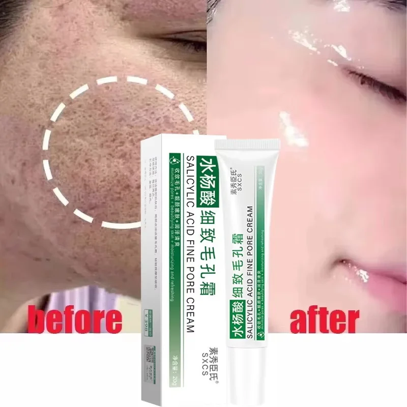 Salicylic Acid Pore Shrinking Cream Quick Elimination Large Pores Remove Blackehead Tighten Face Smooth Skin Korean Care Product view 3