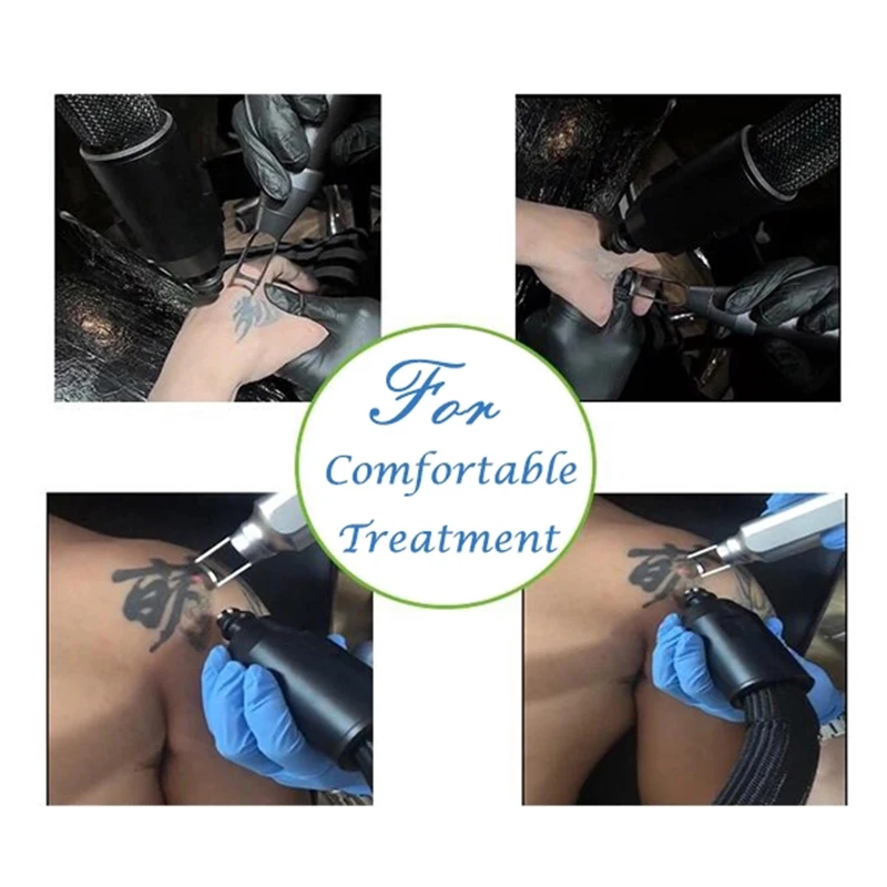 البرد برودة التبريد العلاج آلة التبريد الهواء البارد آلة تبريد الجلد الدائمة غير الجراحية آلة شد الوجه Zeno