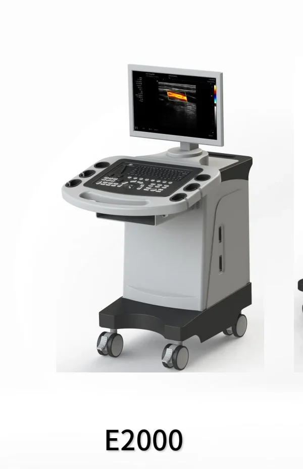 Portable color ultrasound E2000 with abdominal convex array probe