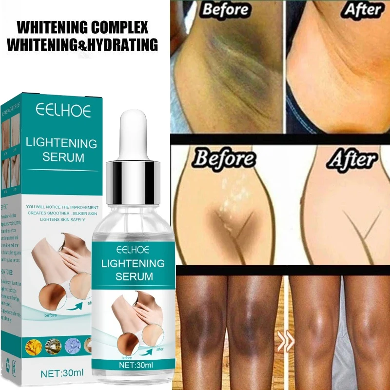 Underarm Beauty Essence Dark Spot Repair Whitening Cream Brighten Knee Body Pigmentation Melanin Removel Moisturize Glowing Skin